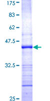 PRKD2 / PKD2 Protein - 12.5% SDS-PAGE Stained with Coomassie Blue.