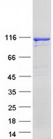 PRKD2 / PKD2 Protein - Purified recombinant protein PRKD2 was analyzed by SDS-PAGE gel and Coomassie Blue Staining