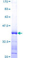 PRKDC / DNA-PKcs Protein - 12.5% SDS-PAGE Stained with Coomassie Blue.
