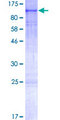 PRKG2 / CGKII Protein - 12.5% SDS-PAGE of human PRKG2 stained with Coomassie Blue