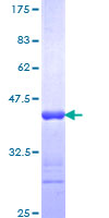 PRKG2 / CGKII Protein - 12.5% SDS-PAGE Stained with Coomassie Blue.