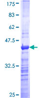 PRKRA / PACT Protein - 12.5% SDS-PAGE Stained with Coomassie Blue.