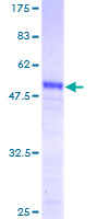 PRKRIP1 Protein - 12.5% SDS-PAGE of human PRKRIP1 stained with Coomassie Blue