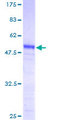 PRKRIP1 Protein - 12.5% SDS-PAGE of human PRKRIP1 stained with Coomassie Blue
