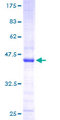 PRKRIR Protein - 12.5% SDS-PAGE of human PRKRIR stained with Coomassie Blue