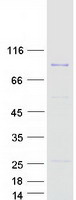 PRKRIR Protein - Purified recombinant protein THAP12 was analyzed by SDS-PAGE gel and Coomassie Blue Staining