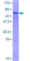 PRKX Protein - 12.5% SDS-PAGE of human PRKX stained with Coomassie Blue