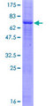 PRKX Protein - 12.5% SDS-PAGE of human PRKX stained with Coomassie Blue
