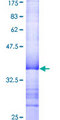 PRKX Protein - 12.5% SDS-PAGE Stained with Coomassie Blue