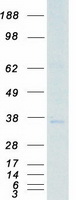 PRKY Protein - Purified recombinant protein PRKY was analyzed by SDS-PAGE gel and Coomassie Blue Staining