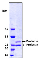 PRL / Prolactin Protein