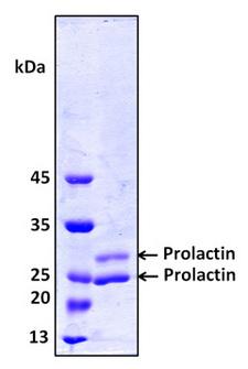 PRL / Prolactin Protein
