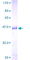 PRL / Prolactin Protein - 12.5% SDS-PAGE of human PRL stained with Coomassie Blue