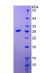 PRL / Prolactin Protein - Recombinant Prolactin By SDS-PAGE