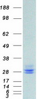 PRL / Prolactin Protein - Purified recombinant protein PRL was analyzed by SDS-PAGE gel and Coomassie Blue Staining