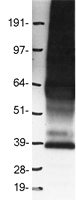 PRLHR / GPR10 Protein - Western validation with an anti-DDK antibody * L: Control HEK293 lysate R: Over-expression lysate