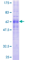 PRLHR / GPR10 Protein - 12.5% SDS-PAGE of human PRLHR stained with Coomassie Blue