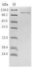 PRLR / Prolactin Receptor Protein - (Tris-Glycine gel) Discontinuous SDS-PAGE (reduced) with 5% enrichment gel and 15% separation gel.