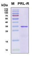 PRLR / Prolactin Receptor Protein - SDS-PAGE under reducing conditions and visualized by Coomassie blue staining