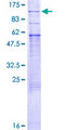 PRLR / Prolactin Receptor Protein - 12.5% SDS-PAGE of human PRLR stained with Coomassie Blue