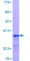 PRLR / Prolactin Receptor Protein - 12.5% SDS-PAGE Stained with Coomassie Blue.