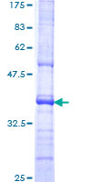 PRLTS / PDGFRL Protein - 12.5% SDS-PAGE Stained with Coomassie Blue.