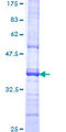 PRLTS / PDGFRL Protein - 12.5% SDS-PAGE Stained with Coomassie Blue.