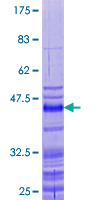 PRM2 / Protamine 2 Protein - 12.5% SDS-PAGE of human PRM2 stained with Coomassie Blue
