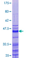 PRM2 / Protamine 2 Protein - 12.5% SDS-PAGE of human PRM2 stained with Coomassie Blue