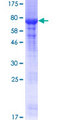 PRMT2 Protein - 12.5% SDS-PAGE of human PRMT2 stained with Coomassie Blue