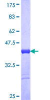 PRMT3 Protein - 12.5% SDS-PAGE Stained with Coomassie Blue.