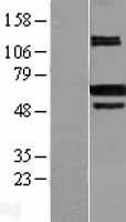 PRMT4 / CARM1 Protein - Western validation with an anti-DDK antibody * L: Control HEK293 lysate R: Over-expression lysate