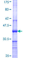 PRMT4 / CARM1 Protein - 12.5% SDS-PAGE Stained with Coomassie Blue.