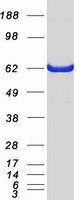 PRMT4 / CARM1 Protein - Purified recombinant protein CARM1 was analyzed by SDS-PAGE gel and Coomassie Blue Staining