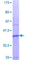 PRMT5 Protein - 12.5% SDS-PAGE Stained with Coomassie Blue.