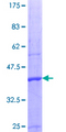 PRMT5 Protein - 12.5% SDS-PAGE Stained with Coomassie Blue.