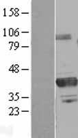 PRMT6 Protein - Western validation with an anti-DDK antibody * L: Control HEK293 lysate R: Over-expression lysate