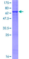 PRMT6 Protein - 12.5% SDS-PAGE of human PRMT6 stained with Coomassie Blue