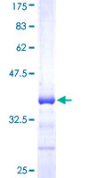 PRMT6 Protein - 12.5% SDS-PAGE Stained with Coomassie Blue.