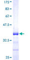 PRMT6 Protein - 12.5% SDS-PAGE Stained with Coomassie Blue.