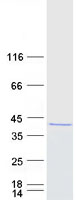 PRMT6 Protein - Purified recombinant protein PRMT6 was analyzed by SDS-PAGE gel and Coomassie Blue Staining
