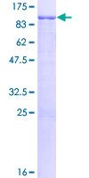 PRMT7 Protein - 12.5% SDS-PAGE of human PRMT7 stained with Coomassie Blue