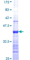 PRMT7 Protein - 12.5% SDS-PAGE Stained with Coomassie Blue.