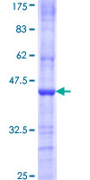 PRMT8 Protein - 12.5% SDS-PAGE Stained with Coomassie Blue.