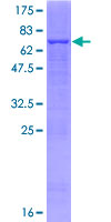 PRMT8 Protein - 12.5% SDS-PAGE of human PRMT8 stained with Coomassie Blue
