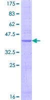 PRND / DOPPEL Protein - 12.5% SDS-PAGE of human PRND stained with Coomassie Blue