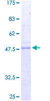 PRNP / PrP / Prion Protein - 12.5% SDS-PAGE of human PRNP stained with Coomassie Blue