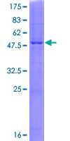 PRNP / PrP / Prion Protein - 12.5% SDS-PAGE of human PRNP stained with Coomassie Blue