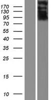PROB1 Protein - Western validation with an anti-DDK antibody * L: Control HEK293 lysate R: Over-expression lysate