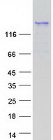 PROB1 Protein - Purified recombinant protein PROB1 was analyzed by SDS-PAGE gel and Coomassie Blue Staining